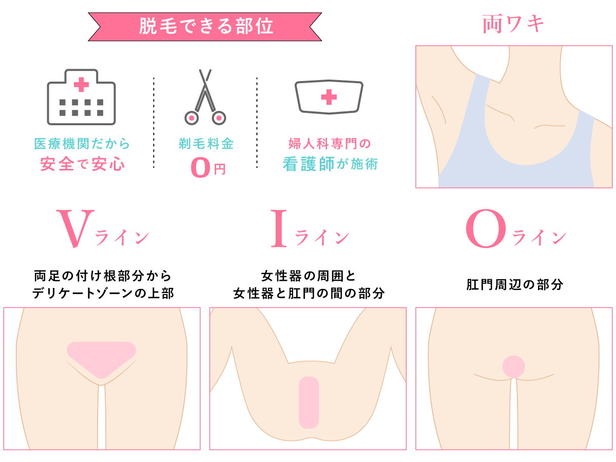 医療レーザー脱毛施術部位