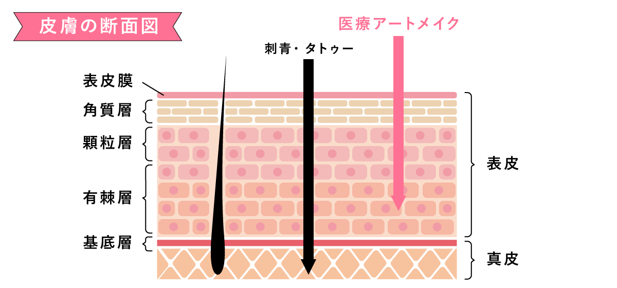 タトゥーとアートメイクの違い