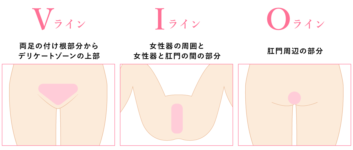 Vライン・Iライン・Oライン