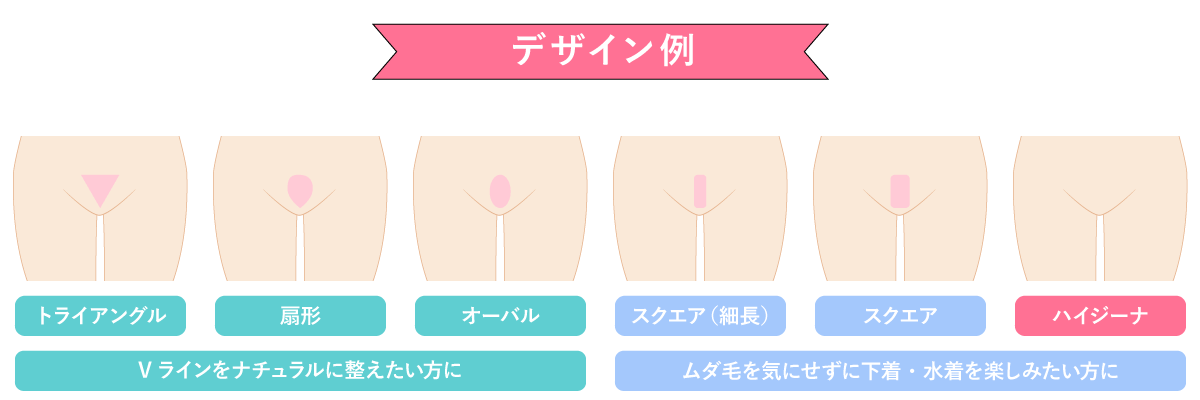 Vラインのデザイン例